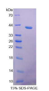 抵抗素样蛋白β(RETNLβ)重组蛋白