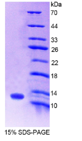 S100钙结合蛋白A8(S100A8)重组蛋白
