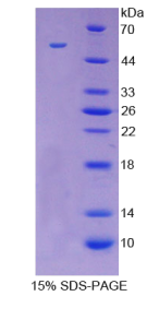 半乳糖凝集素3(GAL3)重组蛋白