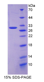 淀粉样前体蛋白(APP)重组蛋白