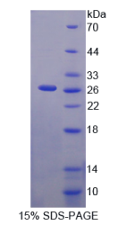 多聚蛋白2(MMRN2)重组蛋白