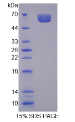 白介素20受体α(IL20Rα)重组蛋白