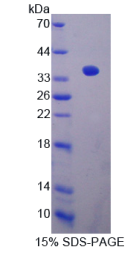 沉默调节蛋白4(SIRT4)重组蛋白