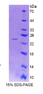 多配体蛋白聚糖4(SDC4)重组蛋白