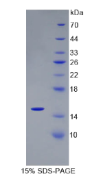 半胱氨酸蛋白酶抑制剂3(CST3)重组蛋白