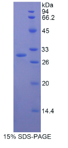 多聚蛋白1(MMRN1)重组蛋白