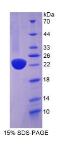 再生胰岛衍生蛋白1β(REG1β)重组蛋白