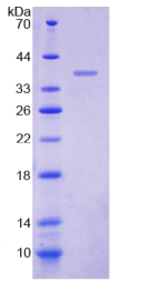 白介素8受体β(IL8Rβ)重组蛋白