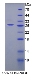 自然杀伤细胞受体2B4(NKR2B4)重组蛋白