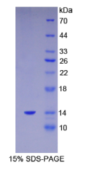 S100钙结合蛋白A11(S100A11)重组蛋白