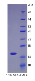 α-胞衬蛋白(SPTAN1)重组蛋白