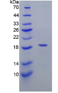 白介素3受体α(IL3Rα)重组蛋白