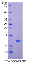 半乳糖凝集素2(GAL2)重组蛋白