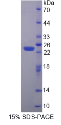 半胱氨酸甘氨酸丰富蛋白1(CSRP1)重组蛋白