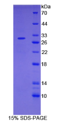 白介素2受体α(IL2Rα)重组蛋白