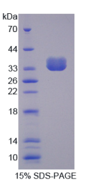 非受体型蛋白酪氨酸磷酸酶6(PTPN6)重组蛋白