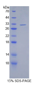 S抗原(SAG)重组蛋白