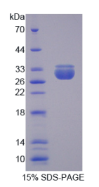 转运蛋白2(TNPO2)重组蛋白