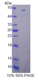 白介素12B(IL12B)重组蛋白