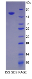 白介素35(IL35)重组蛋白