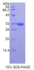 GRB2相关衔接蛋白2(GRAP2)重组蛋白