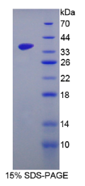 SRSF蛋白激酶3(SKL3)重组蛋白