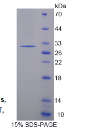垂体肿瘤转化蛋白1(PTTG1)重组蛋白