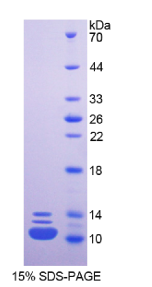 不均一核糖核蛋白A2/B1(HNKL2B1)重组蛋白