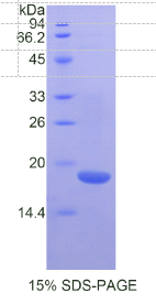 δ样蛋白1同源物(δLK1)重组蛋白