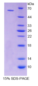 CD19分子(CD19)重组蛋白