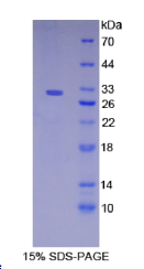 Nicastrin蛋白(NCSTN)重组蛋白