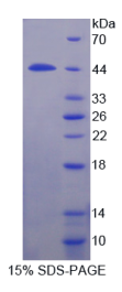 白介素12受体β1(IL2Rβ1)重组蛋白