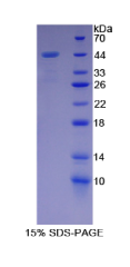 转化生长因子β3(TGFβ3)重组蛋白