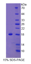 补体应答基因32(RGC32)重组蛋白