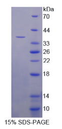 氨酰tRNA合成酶复合多功能相互作用蛋白1(AIMP1)重组蛋白