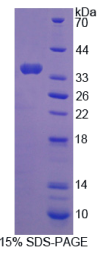 C-Ros癌基因1(ROS1)重组蛋白