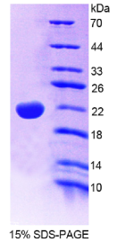 白介素22(IL22)重组蛋白