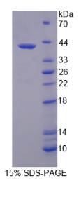 S-期激酶关联蛋白2(SKP2)重组蛋白
