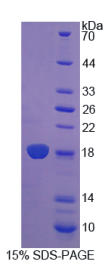 再生胰岛衍生蛋白3β(REG3β)重组蛋白