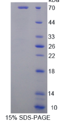 半乳糖凝集素9(GAL9)重组蛋白