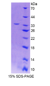 白介素12B(IL12B)重组蛋白