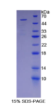 次黄嘌呤磷酸核糖基转移酶1(HPRT1)重组蛋白