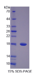 泛酸激酶4(PANK4)重组蛋白