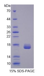 半乳糖凝集素2(GAL2)重组蛋白