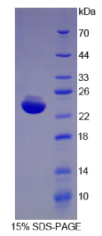 白介素1β(IL1β)重组蛋白