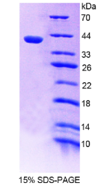 Dickkopf相关蛋白3(DKK3)重组蛋白