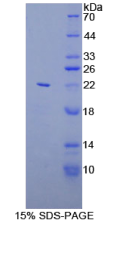 T-细胞激活连接蛋白家族成员2(LAT2)重组蛋白