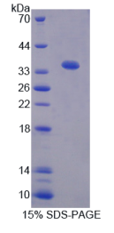 Tsukushin蛋白(TSK)重组蛋白