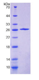 Vav1癌基因(VAV1)重组蛋白