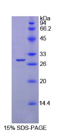 蛋白酪氨酸磷酸酶受体S(PTPRS)重组蛋白